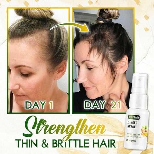 Spray De Jengibre HairSOS Plus ReGrowth