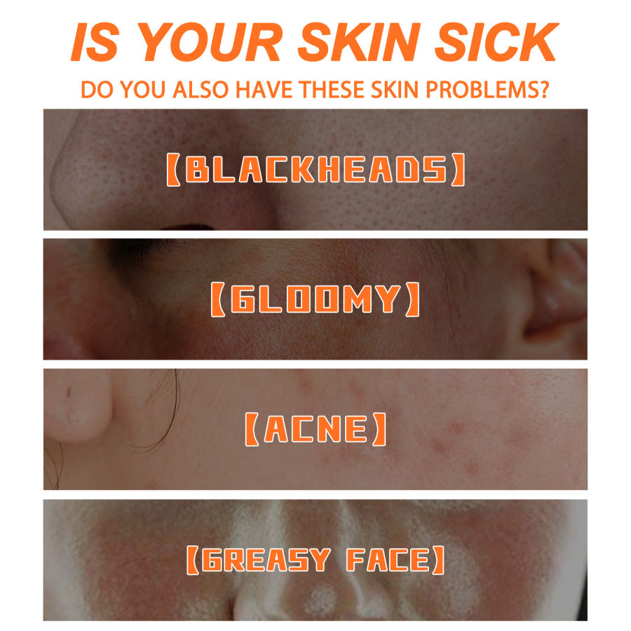 Nueva Máscara De Burbujas De Zanahoria Mágica