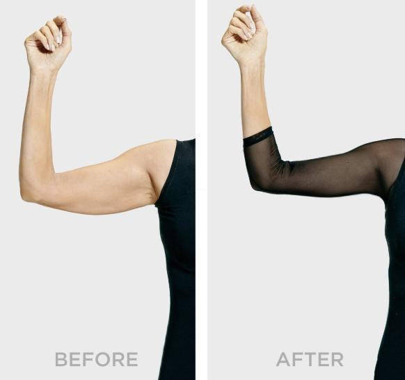 Moldeador de brazo adelgazante