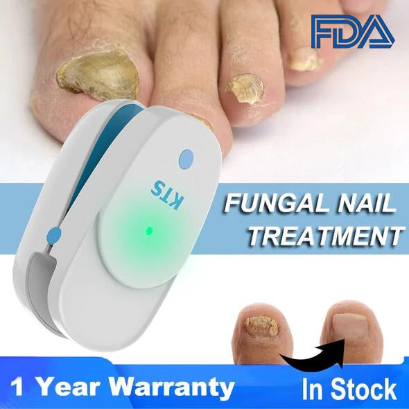 Blanqueamiento Para El Cuidado De Los Pies Con Láser Para Hongos En Las Uñas Por Infrarrojos