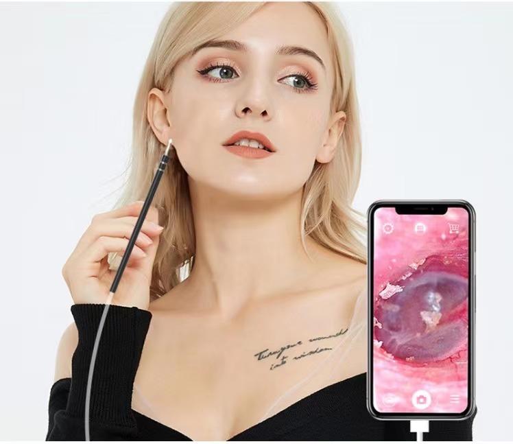 EL KIT DE LIMPIEZA DE OÍDOS MÁS INTELIGENTE 2021