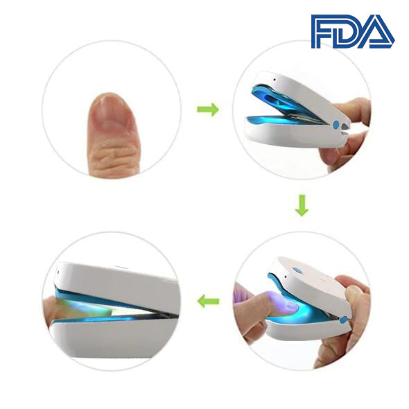 Blanqueamiento Para El Cuidado De Los Pies Con Láser Para Hongos En Las Uñas Por Infrarrojos