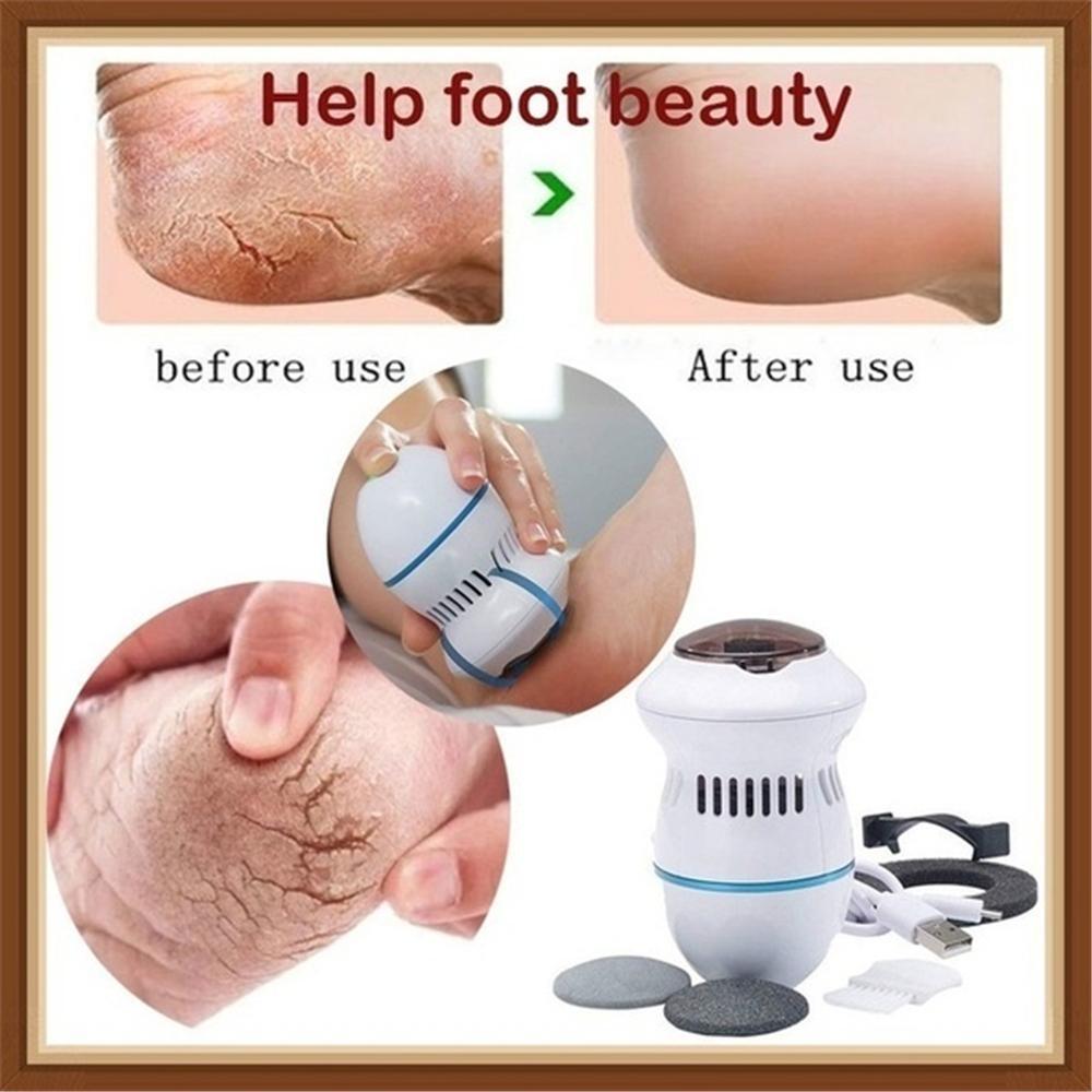 Eliminador de callos eléctrico, lima portátil para pieles muertas