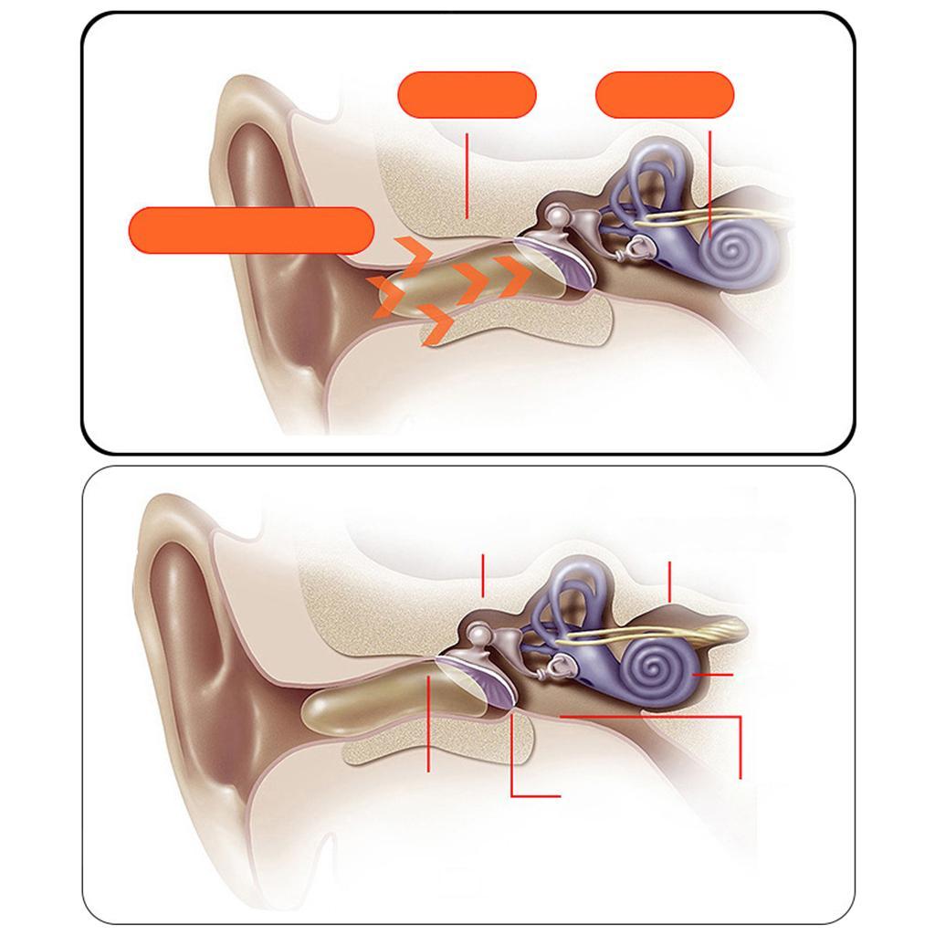 Auriculares Bluetooth 5.0 De Conducción ósea 13 Horas De Tiempo De Reproducción De Graves Para Entrenamientos
