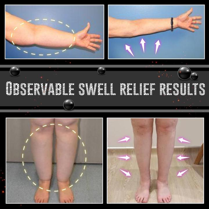 [001] Pulsera De Obsidiana Antihinchazón