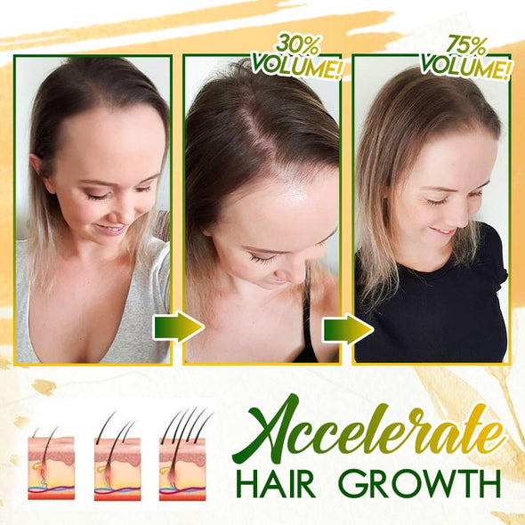 Spray De Jengibre HairSOS Plus ReGrowth