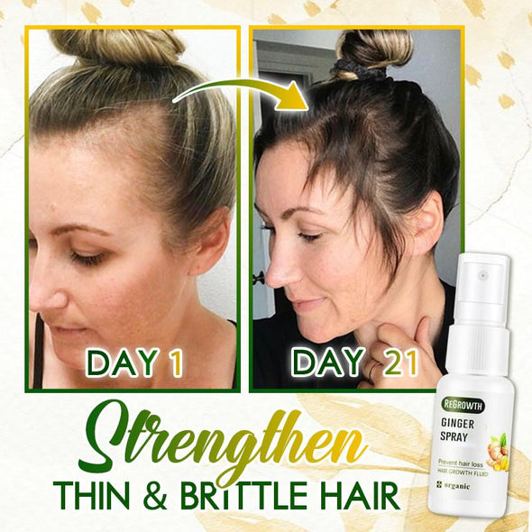 Spray De Jengibre HairSOS Plus ReGrowth