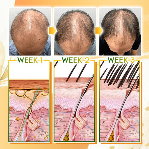 Spray De Jengibre HairSOS Plus ReGrowth