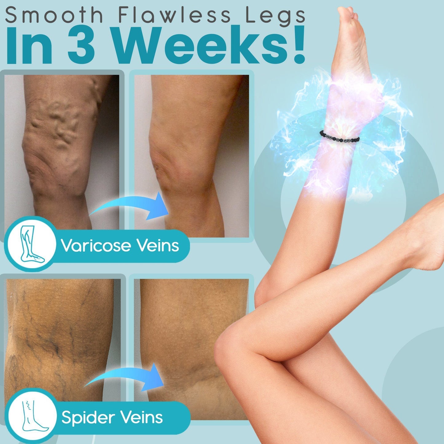 [001] Tobillera De Magnetoterapia Antivaricosa E Inflamatoria