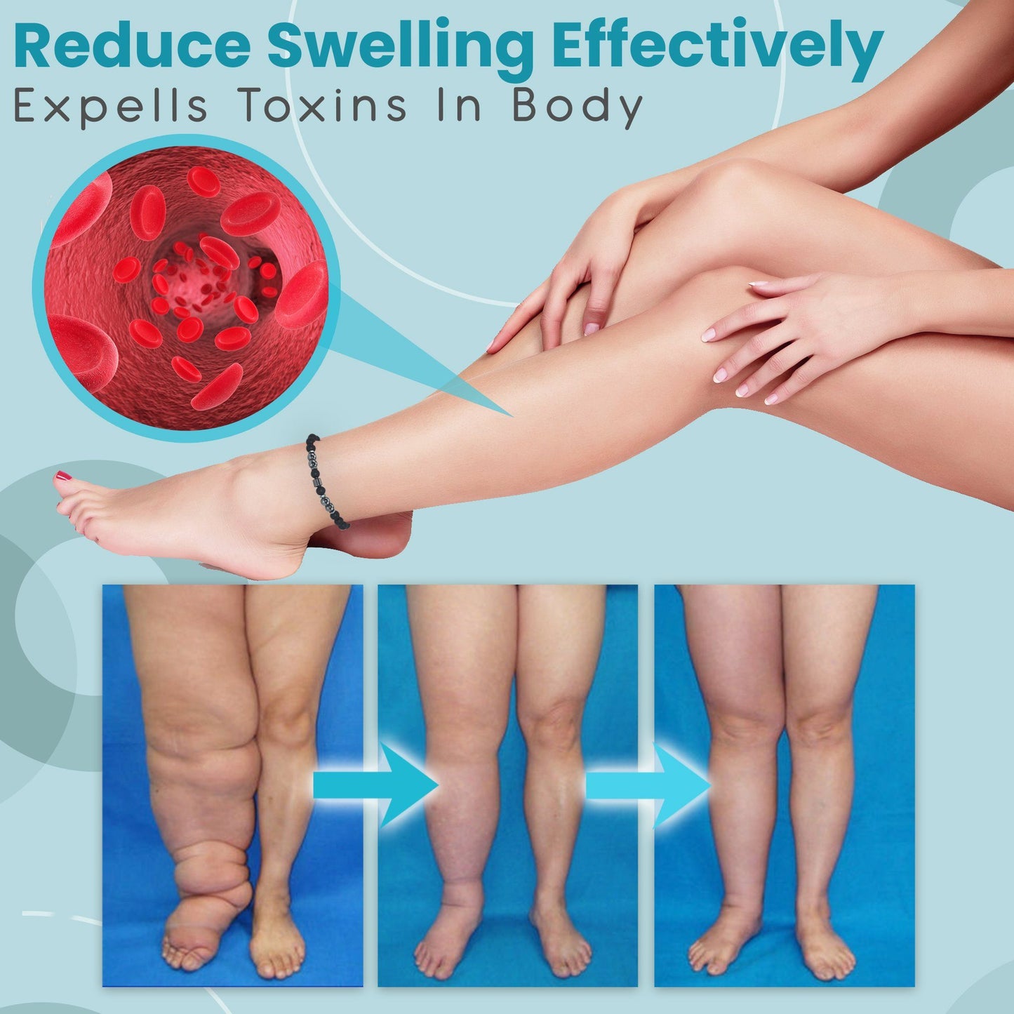 [001] Tobillera De Magnetoterapia Antivaricosa E Inflamatoria