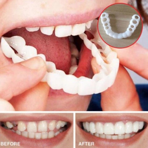 Sonrisa diente artificial (Dientes superiores + Dientes inferiores)